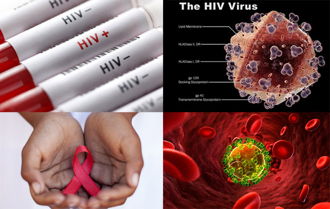 Bagaimana Cara untuk Mengobati Penyakit AIDS?