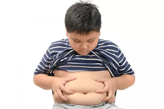 Cara Ampuh Mengatasi Obesitas